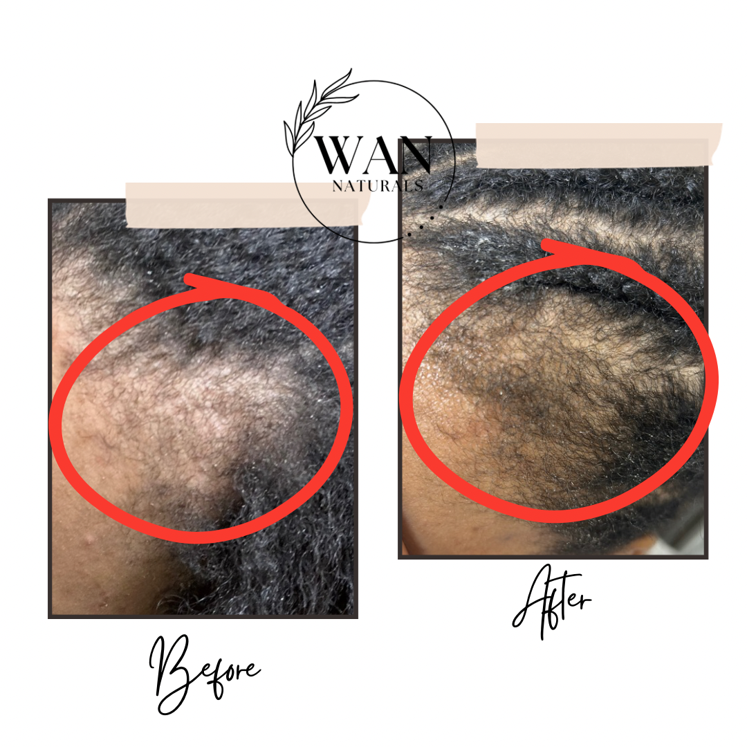 Hibiscus & Lavender Growth Oil