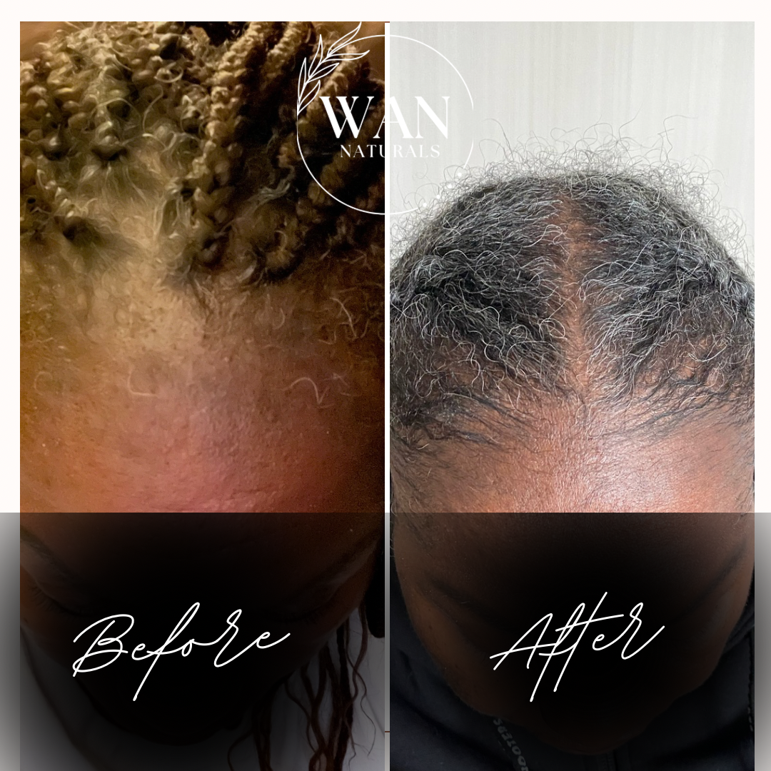 Clove & Rosemary Herbal Oil