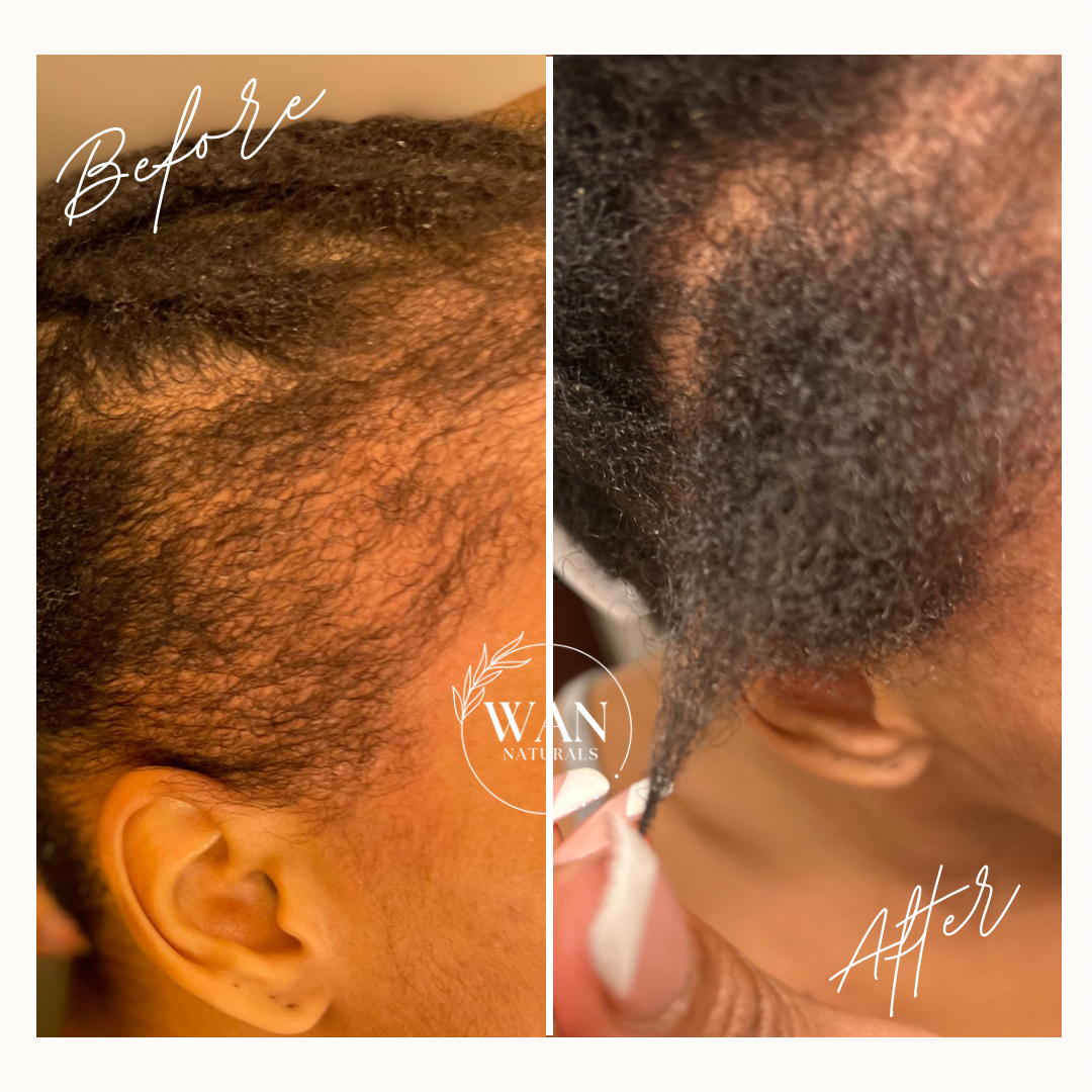 Clove & Rosemary Herbal Oil