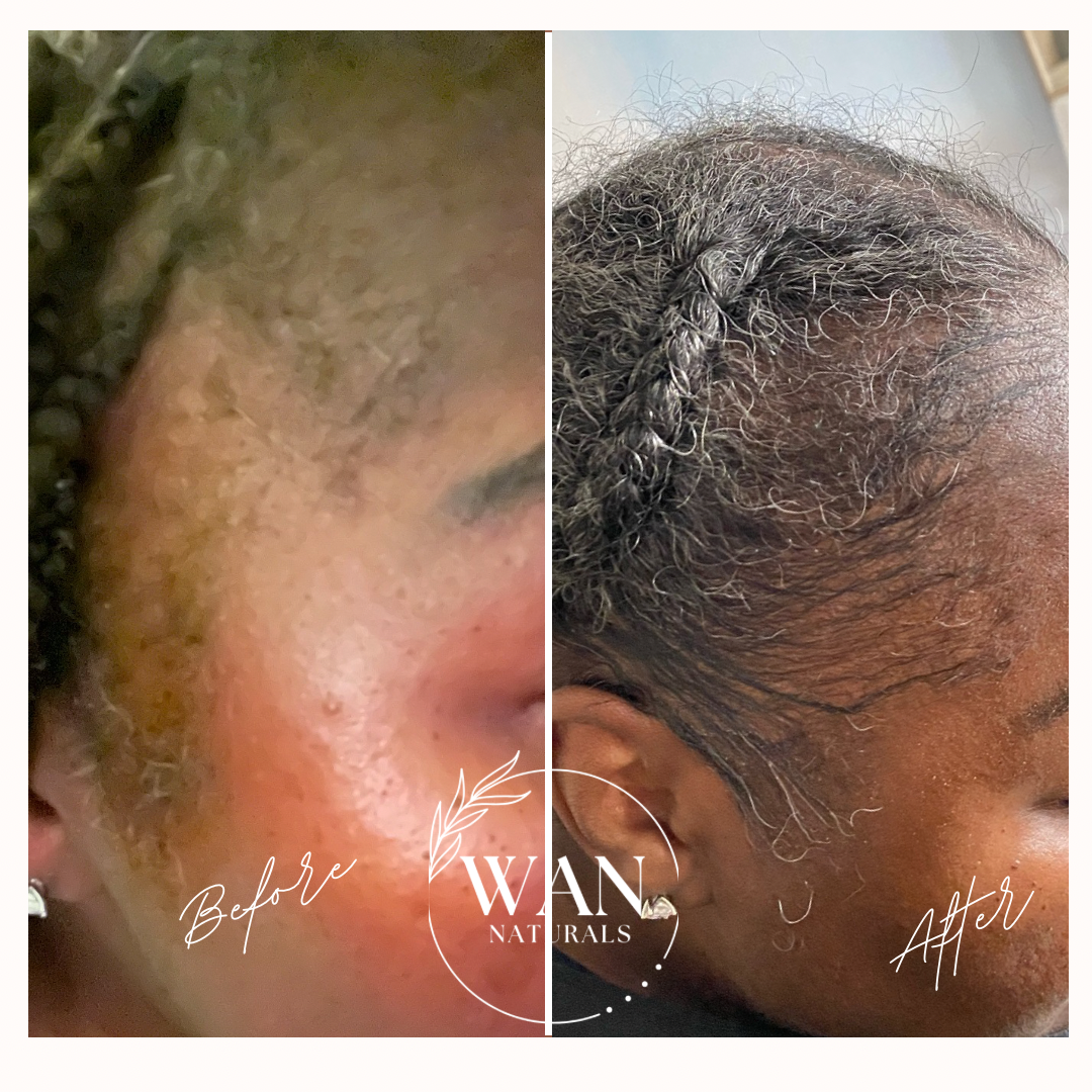 Clove & Rosemary Herbal Oil