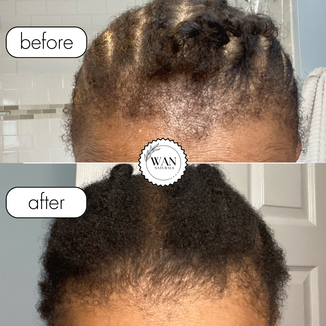 Clove & Rosemary Herbal Oil